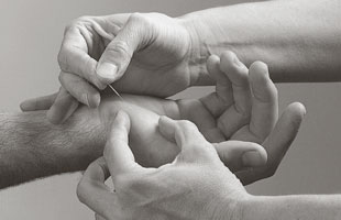 ITEA 5 element acupuncture practitioner track program